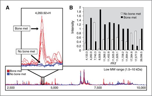 Figure 2. Biomarker signature of breast cancer bone metastasis. A, comparative low-molecular weight (MW) SELDI-TOF MS profiles of breast cancer patient plasma. Blue, no bone metastasis; red with bone metastasis. Inset, expanded view showing the discriminatory 4,260 Da peak present in patients with bone metastasis (red) and absent in patients with no bone metastasis (blue). B, diagnostic fingerprint showing intensity and molecular weight (m/z) of the 13 discriminatory peaks identified in breast cancer patient plasma. White bars, no bone metastasis; black bars, with bone metastasis.