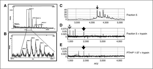 Figure 3. Monoisotopic mass and tryptic mapping of PTHrP(12-48) in patient plasma. A, mass spectrometry profile of breast cancer patient plasma identifying the SELDI 4,260 m/z peak as 4,255.3 m/z using MALDI. B, the isotopic profile of the 4,255.3 peak identified the monoisotopic mass as 4,253.3 m/z. C, SELDI profile of fractionated bone metastasis patient plasma, fraction 5. Arrow indicates the m/z 4,260 peak of interest. D, fraction 5 sample after trypsin digestion. Solid arrow m/z 1,947.06; hashed arrow m/z 1,116.55. Both tryptic peptides are as predicted for the trypsin cleavage of PTHrP(12-48). E, control PTHrP(1-37) tryptic peptide map identified the predicted m/z 1,947.06 peptide (solid arrow).
