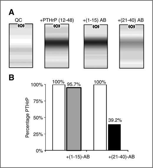 Figure 4. Specificity of PTHrP antibodies. A, gel view of SELDI spectra. Quality control (QC) serum was spiked with PTHrP(12-48; 750 ng/mL) and then immunodepleted with either PTHrP(1-15)-AB or PTHrP(21-40)-AB. Addition of the (21-40)-AB significantly depletes spiked PTHrP(12-48). B, quantification of the immunodepletion from (A). All bars quality control serum spiked with PTHrP(12-48). Gray bar + (1-15)-AB; Black bar + (21-40)-AB. Bar labels identify percentage of PTHrP(12-48) remaining after immunodepletion and show specificity of the (21-40)-AB for detecting PTHrP(12-48).
