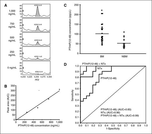Figure 6. Specific SELDI-based measurement of PTHrP(12-48) in patient plasma. A, representative SELDI profiles of quality control (QC) plasma containing 0, 250, 500, 750, and 1,000 ng/mL PTHrP(12-48). Specific peak area measured is highlighted. B, standard curve for the measurement of PTHrP(12-48) in spiked quality control plasma (R2 = 0.985). C, PTHrP(12-48) plasma concentrations measured in patients with [bone metastasis (BM)] and without bone metastasis (NBM). PTHrP(12-48) levels are significantly increased in patients with bone metastasis. *, P < 0.05. D, ROC curves for the measurement of PTHrP(12-48) and NTx in patient plasma. The determined accuracy of PTHrP(12-48) and NTx is not significantly different. The combination of NTx and PTHrP(12-48) is the most accurate (AUC = 0.99).