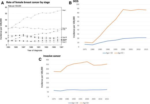 Figure 2. Female breast cancer by stage in the United States. A, Incidence rates from 1983 to 1997 across all stages. Since the introduction of screening in 1983, the detection rates of in situ and stage 1 cancers have increased dramatically. However, that has not come with a concomitant decrease in stage 2 and higher stage cancers. In fact, stage 2A cancers have not changed, there has only been a very modest decrease in the incidence of stage 2B cancers, stage 3 have increased slightly, and stage 4 has remained flat. B, The incidence rates of DCIS from 1975 to 2015 in the United States are shown for women above and below 50 as well as for invasive cancer in C. The drop in invasive cancer cases in 2003 in women >50 corresponded to the enormous drop in the use of combined hormone replacement therapy after the WHI study results were published. The incidence of invasive breast cancer in the United States based on SEER from 1975 to 2015 is shown in C. Despite the rise in the rates of DCIS, no drop in the detection rates of invasive cancer, even a decade after the rise in DCIS, suggesting that the majority of these cases are not likely to be precursors' consequential invasive cancer. Interestingly, if this is compared to rates of DCIS in the Netherlands, the rise in DCIS in the Netherlands was only seen in women of screening age (>49–70) and not in women <50.