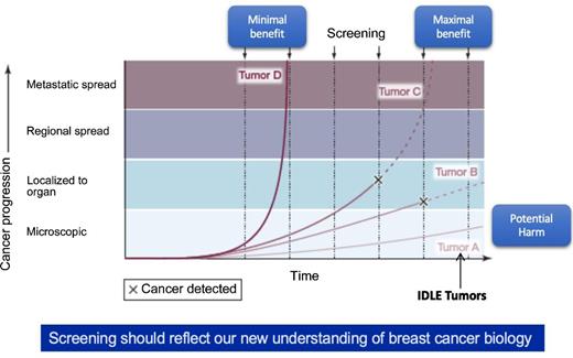 Figure 3. The impact of periodic screening based on different growth rates of breast cancer subtypes. Growth rates of Tumors A–D are displayed from microscopic disease to localized, to regional, to metastatic. Tumor A is clinically undetectable and could remain that way throughout the patient's lifetime. Tumor B grows until it becomes palpable but may not progress to metastatic disease and remain localized. Tumor C grows and would ultimately become metastatic, but early detection could result in reducing mortality from breast cancer. Tumor D grows rapidly and may have metastatic potential even when small, thus systemic therapy is critical for these high-risk cancers. Periodic screening may not be sufficient to make a difference in outcomes for these types. Tumor C is likely to be the most likely to benefit from screening. Reprinted with permission from JAMA (ref. 20).