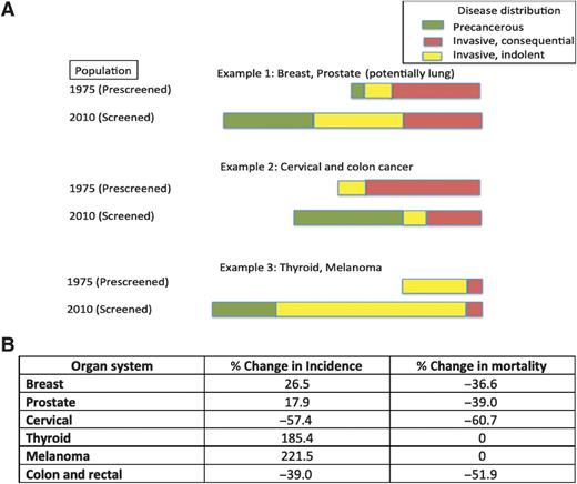 Figure 5. Tumors exhibit a range of biological behavior, and the heterogeneity of the population depends both on the organ of origin and frequency of screening. Screening will necessarily surface an increased range of precancerous lesions and indolent disease. A, The schematic shows three patterns based on the SEER incidence rates. In example 1, the prescreened population has a substantial proportion of a consequential cancers, but an indolent reservoir is surfaced with screening leading to an overall increase in incidence rates. Adjuvant treatment also plays a role in reducing mortality which complicates assessment, but there is likely a contribution that screening makes to mortality reduction. In example 2, the prescreened population is likely more homogenous, slower growing but consequential, and screening substantially decreases both the incidence and mortality. In this example, precancerous lesions that are detected appear to be precursors of more consequential disease. Here is where screening makes maximal impact. In example 3, the biology of prescreened tumors is more homogenous, slower growing and the majority are indolent. Here screening substantially expands the indolent population with little or no impact on small population of more aggressive behaving tumors. B, Adjoining table shows chance in incidence and mortality of cancers over time from 1975 to 2017 as reported by SEER (22, 36).