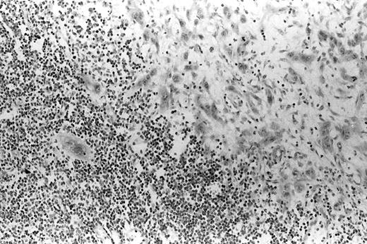 Fig. 3. ISH showed negative EBER-1 signal in ESCC. ×100.