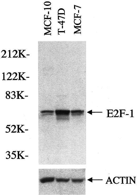 Fig. 2. Western blot analysis of nontumorigenic MCF-10F cells as well as breast carcinoma-derived T-47D and MCF-7 cells. The T-47D and MCF-7 breast carcinoma cell lines expressed 3.8 and 2.4 times, respectively, more E2F-1 protein than the nontumorigenic cell line. The E2F-1 bands in the exposed film were normalized with their respective actin bands and were evaluated densitometrically with the NIH Image 1.61 software (NIH,Bethesda, MD).