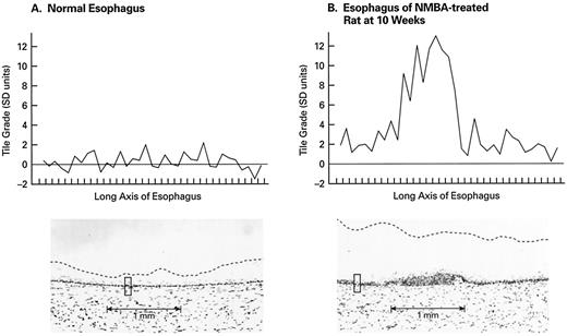 Fig. 1. Tile grades measured along the long axis of portions of esophagus from an untreated rat (A) and an NMBA-treated rat (B). Each tic on the abscissa of A and Brepresents the width of one tile, 84 μm. Below each graph is a histological section of a segment of esophagus in which the size of one tile is illustrated. In the histological section below B, a plaque of high-grade intraepithelial neoplasia is shown.