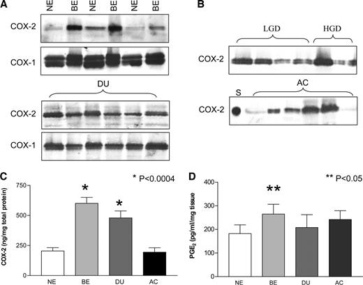 Fig. 1. A, representative Western blots showing cyclooxygenase (COX)-1 and COX-2 (molecular weight, 70,000 and 72,000, respectively) from normal esophageal squamous epithelium (NE), Barrett’s epithelium (BE), and duodenum (DU). The two bands in COX-1 are due to N-glycosylation of the protein. B, Western blots of COX-2 in Barrett’s low-grade dysplasia (LGD), high-grade dysplasia (HGD), and esophageal adenocarcinoma (AC). S is the recombinant COX-2 standard. C, cumulative data obtained from densitometric analysis of Western blots for NE (n = 25), BE (n = 51 biopsies from 35 patients), DU (n = 15), and esophageal AC (n = 15). ∗, P < 0.0004, BE and DU versus NE. D, prostaglandin E2 (PGE2) expression in organ culture media determined by enzyme immunoassay after a 24-h incubation. Data are presented as mean ± SE. ∗∗, P < 0.05, BE versus NE.
