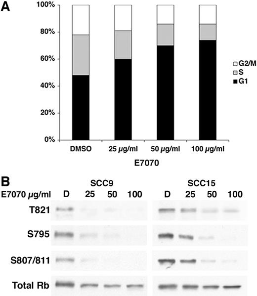 Fig. 1. A, SCC9 cells were treated with DMSO or E7070 for 24 h, and DNA content was analyzed by flow cytometry. B, SCC9 and SSC15 cells were treated with DMSO (D) or E7070 at the indicated concentrations; nuclear lysates were analyzed for phospho-retinoblastoma (Rb) and total Rb with the indicated antibodies.