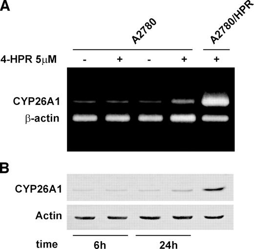 Fig. 2. Effect of 4-HPR on the expression of CYP26A1 in A2780 and A2780/HPR cells. CYP26A1 gene expression was analyzed in A2780 cells after one single treatment with 5 μmol/L 4-HPR [for 6 (6h) and 24 hours (24h)] and in A2780/HPR constantly maintained in the presence of 5 μmol/L 4-HPR (19). In A, CYP26A1 mRNA expression was measured by RT-PCR assay. Two μg of total RNA were retrotranscribed, and the gene sequences for CYP26A1 and β-actin, used as internal standard, were coamplified in the same reaction. In B, CYP26A1 protein expression was analyzed by Western blot analysis. Eighty μg of protein were loaded onto an SDS-PAGE gel, and were immunoblotted with antibody against CYP26A1. As a control for loading, the blot was incubated with actin antibody. +, presence of 4-HPR, −, absence of 4-HPR.