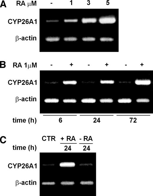Fig. 3. Effects of RA on the expression of CYP26A1 in A2780 cells. CYP26A1 gene expression was measured by RT-PCR assay in A2780 cells treated with RA. Two μg of total RNA were retrotranscribed, and the gene sequences for CYP26A1 and β-actin, used as internal standard, were coamplified in the same reaction. In A, A2780 cells were treated with 1, 3, and 5 μmol/L RA for 24 hours. In B, A2780 cells were exposed to 1 μmol/L RA for 6, 24, and 72 hours [time (h)]. −, absence of RA, +, presence of RA. In C, A2780 cells were treated with 5 μmol/L RA for 24 hours (+RA); then the drug was washed out and the cells were refed with fresh culture medium, without RA (−RA), and were harvested 24 hours later. CTR, control cells..