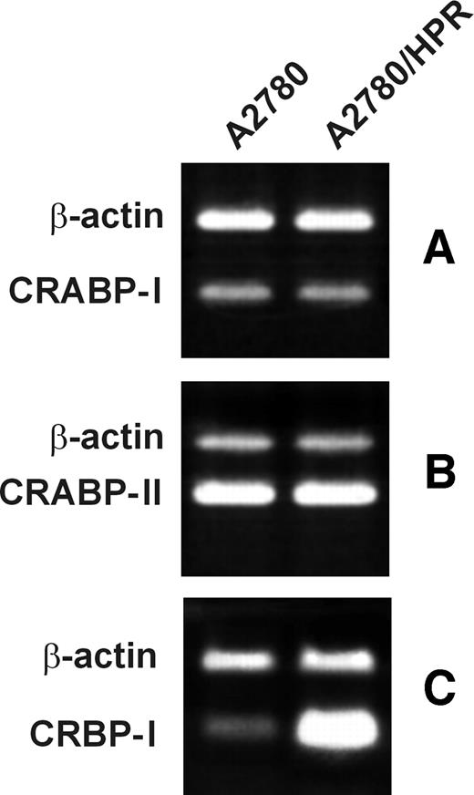 Fig. 6. CRABP-I, CRABP-II, and CRBP-I expression in A2780 and A2780/HPR cells. CRABP-I, CRABP-II, and CRBP-I gene expression was measured by RT-PCR assay in A2780 and A2780/HPR cells. Twenty-four hours after seeding, A2780 and A2780/HPR cells were harvested, and total RNA was extracted. Two μg of total RNA were retrotranscribed, and the gene sequences for CRABP-I, CRABP-II, CRBP-I, and β-actin, used as internal standard, were coamplified in the same reaction.