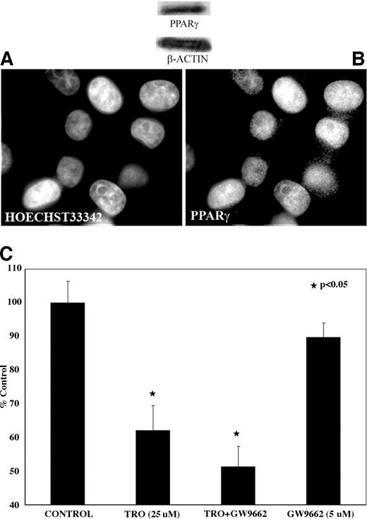 Fig. 5. TRO-induced decreased DNA synthesis is not blocked by GW9662. (A) Immunofluorescent images (original magnification, ×60) show the predominantly nuclear localization of PPARγ. MDA-MB-231 cells were stained with Hoechst 33342 (nuclear dye, left panel), anti-PPARγ antibody, and secondary fluorescent antibody (right panel). PPARγ colocalizes with the nuclear stain. B, PPARγ Western blot. Total protein from whole cell lysate was separated on a 10% SDS-PAGE gel, transferred to membrane, and labeled with anti-PPARγ monoclonal antibody. Membrane was stripped and reprobed with anti–β-actin for equal load. C, [3H]thymidine labeling in MDA-MB-231 cells. Cells were incubated in fresh DMEM/10% FCS plus 1 μCi/mL [3H]thymidine for 18 hours and treated with either control (DMSO only), 25 μmol/L TRO, 5 μmol/L GW9662, or 25 μmol/L TRO + 5 μmol/L GW9662. Results are radiolabel incorporation as a percentage of time controls (n = 3; *, P < 0.05).