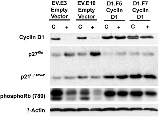 Fig. 8. Effect of gefitinib treatment on cyclin D1 and CDK inhibitor expression in cyclin D1-overexpressing SCC 9 cells. Cells were treated with 2 μmol/L gefitinib or vehicle (DMSO) for 24 hours, harvested, and Western Blot analysis of cyclin D1, phosphorylation at pRb Serine 780 [phosphoRb (780)] p27KIP1, and p21WAF1/CIP1 was done. β-actin was used as a loading control.