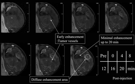 Fig. 1. Dynamic magnetic resonance images with G8-Gd-D of a relatively large SCCVII tumor (16 mm in diameter) 12 hours after γ-irradiation (15 Gy). Images were obtained immediately after injection of contrast agent and were acquired in 111 seconds. The zero time point is defined as completion of the first scan.