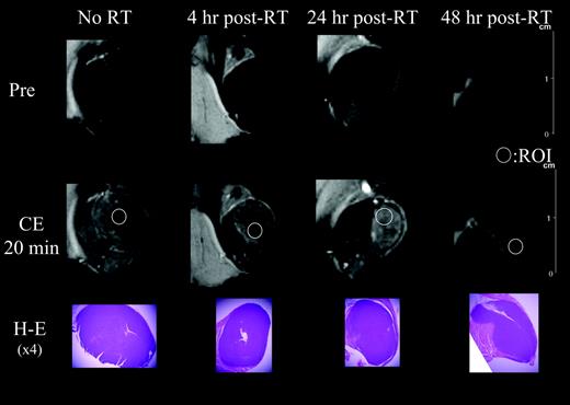 Fig. 5. Representative pre- and post-enhanced magnetic resonance images. Magnetic resonance images of the SCCVII tumor are shown at selected time points pre- and postirradiation (15 Gy). Corresponding micrographs of the H&E staining are presented for histologic comparison of the effects on the xenografts (magnification ×4). (ROI, regions of interest)