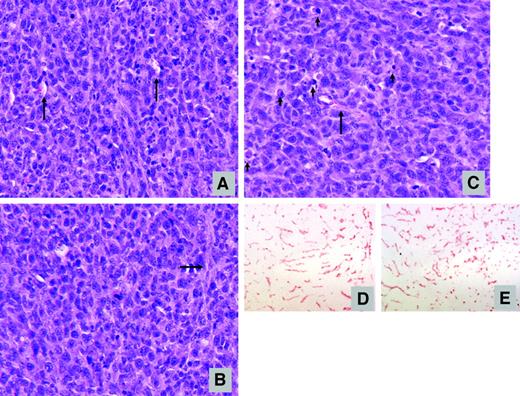 Fig. 6. Histology of irradiated SCCVII tumor xenografts. SCCVII tumors were harvested at selected time points after irradiation (15Gy) for histologic examination. H&E staining are shown for (A) nonirradiated tumor, (B) 24 hours after irradiation, and (C) 48 hours after irradiation. Infiltrating macrophages and eosinophils (arrowheads) are located near microvessels (arrows). Micrographs of SCCVII tumor sections stained for PECAM-1 are also shown: (D) nonirradiated tumor and (E) 24 hours after irradiation.