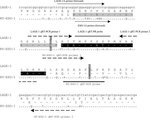 Fig. 1. DNA and translated protein sequence of the variable part of the NY-ESO-1 and LAGE-1 mRNA: (dotted line) identical oligonucleotide sequence; (dashed lines) identical amino acid sequence; RT-PCR primer binding sites (→); qRT-PCR primer (▸) and probe (solid line) binding sites; NY-ESO-173–90 epitope, which binds E978 , or NY-ESO-191–108, which binds ES121 ▪ polymorphisms in LAGE-1 DNA and/or protein sequence .