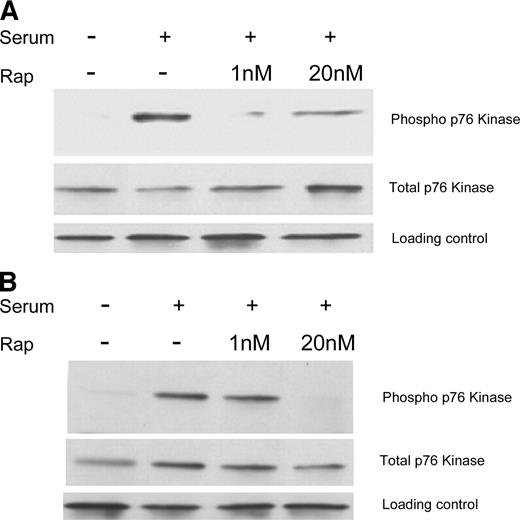 Fig. 3. Western blot analysis. After treatment with rapamycin, there was a reduction in phosphorylated S6K in HepG2 (A) and Hep3B (B) cell lines. No change is seen in total S6K.