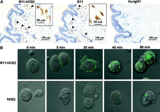 Fig. 2. A, immunohistochemical labeling of human skin with human anti-dendritic cell (DC) antibody (B11)-human chorionic gonadotropin β subunit (hCGβ). Normal human skin sections were incubated with FITC-B11-hCGβ, FITC-B11, or FITC-human IgG1 (control) and detected using an immunoperoxidase method as described in “Materials and Methods.” Positive labeling (brown) for B11-hCGβ and B11 was associated with dermal DC and macrophages (arrowheads). The inserts represent higher power magnification. B, binding and internalization of B11-hCGβ by DCs. Monocyte-derived DCs were pulsed with FITC-B11-hCGβ or FITC-hCGβ for 30 min on ice. Cells then were incubated at 37°C for the indicated periods to allow for internalization. Images were taken by confocal microscopy, and green staining indicates the presence of FITC-labeled molecules.