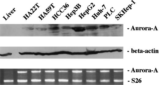Fig. 2. Overexpression of Aurora-A in liver cancer cell lines. Protein lysates from nontumorous liver tissue and 8 liver cancers cell lined were analyzed by immunoblotting. All 8 liver cancer cell lines show overexpression of Aurora-A at protein level (top panel). The blots were reprobed with β-actin as a control for protein loading. The protein expression levels were correlated with mRNA level (bottom panel).