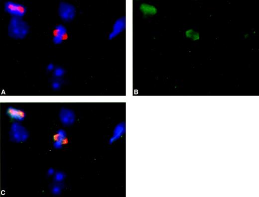 Fig. 3. Localization of Aurora-A at interphase and metaphase Hep3B cell lines. A, Aurora-A was visualized with anti-aurora-A antibody and Rhodamine-conjugated secondary antibody (red). DNA was labeled with 4′,6-diamidino-2-phenylindole staining (blue). Aurora-A shows perinuclear dot-like staining in interphase cells and located at mitotic spindle in metaphase cells. B, γ-tubulin, a marker of centrosome, was stained with anti-γ-tubulin antibody and FITC-conjugated secondary antibody. C, merge of A and B. Aurora-A and γ-tubulin colocalized at centrosome and mitotic spindle.