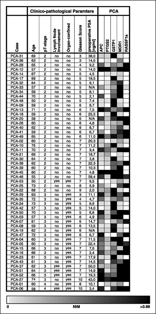 Fig. 2. Gene hypermethylation (expressed as NIM) at five gene loci (CpG islands) in prostate cancer tissues specified in the graph and arranged according to pT stage and Gleason score. See Fig. 1 for further details.