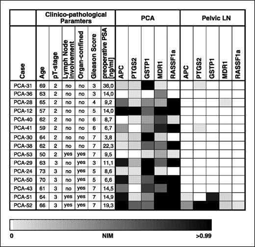 Fig. 3. Gene hypermethylation (expressed as NIM) at five gene loci (CpG islands) in tissues from various pelvic lymph nodes (LN) and the corresponding primary prostate cancer as specified in the graph. See Fig. 1 for further details.