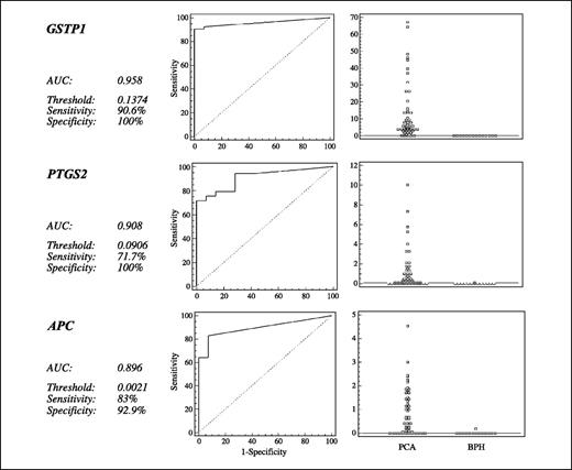 Fig. 4. Optimal sensitivity and specificity determination for the three hypermethylated gene loci (CpG islands) in primary prostate cancer that were most promising in diagnosis. Left, receiver operator curve analysis was used to determine the methylation (NIM) threshold that yields the optimal sensitivity and specificity for each of the three hypermethylated gene loci. Right, histograms of the NIM of all prostate cancers and benign specimens are shown for each gene locus. The threshold NIM, the optimal sensitivity and specificity, and the area under the receiver operator curve (AUC) are shown for each gene locus.