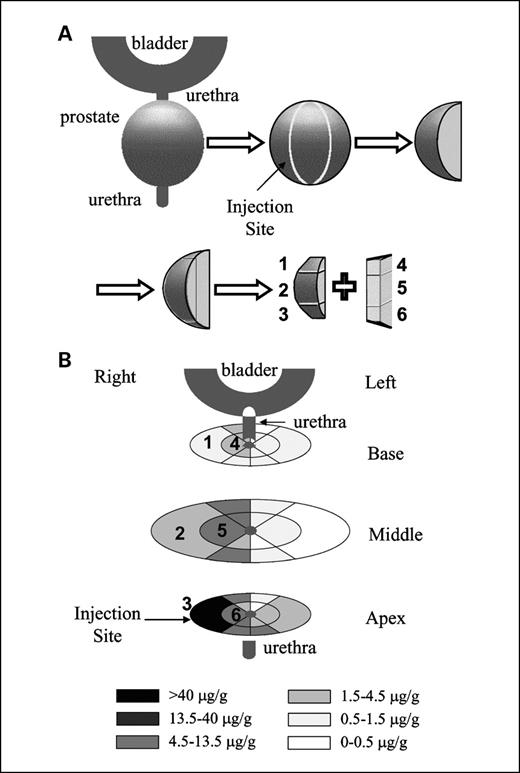 Fig. 1. Spatial drug distribution in the prostate after intraprostatic infusion: three-dimensional composite. Doxorubicin, 0.42 mg/210 μL, was infused over 150 minutes directly into the prostate of dogs (n = 6). A, tissue processing procedures. The prostate was first divided into two lateral halves along the urethra, and each half was further separated into three wedges. Each wedge was sectioned into peripheral and central segments, and each segment was then divided into three parts: base, middle, and apex. This yielded six parts per wedge, or total of 36 parts. The tissue parts are numbered. B, doxorubicin distribution in a representative prostate. The numbers of tissue parts correspond to the numbers used in (A).