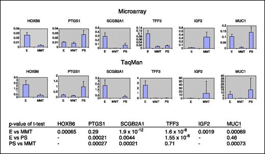 Fig. 4. Microarray expression and quantitative PCR (TaqMan) expression analysis of six selected genes differentially expressed between mixed mullerian tumors, endometrial carcinoma, and papillary serous carcinoma.
