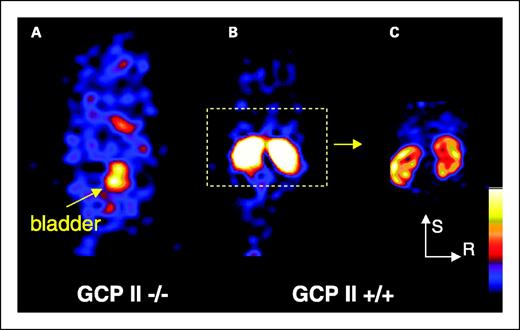Fig. 3. SPECT imaging of [125I]DCIT in GCPII knockout (A) and wild-type (B and C) animals. Images (A and B) were obtained with a parallel-hole collimator and are scaled to the same maximum. Image (C) is from the same animal as in (B), except using a higher-resolution, pinhole collimator. Animals devoid of GCPII show no renal binding of radiopharmaceutical.