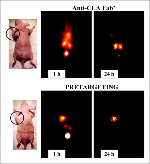 Fig. 5. Static images taken of nude mice bearing ∼1.0 g GW-39 human colonic tumor xenografts (top left shoulder, circled) and given either 40 μCi 99mTc-anti-CEA F(ab′) (top) or 40 μCi 99mTc-peptide-di-HSG hapten 48 hours after the administration of a recombinant anti-CEA × anti-HSG bispecific mAb (bottom). Anesthetized animals were placed face down on a low-energy, high-resolution collimator fitted to an ADAC Solus camera. The same animal in each group was imaged at 1 hour (100,000 counts per image) and 24 hours (20-minute images, ∼12,000-15,000 counts per image) after the 99mTc injections.