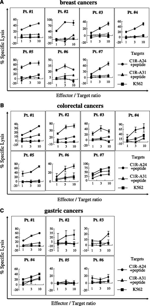 Fig. 4. Induction of HLA-A24-restricted CTL from PBMCs of HLA-A24+ breast, colorectal, and gastric cancer patients. CTLs were induced from PBMCs of HLA-A24-positive breast (A), colorectal (B), and gastric (C) cancer patients by MLPC with survivin-2B80-88 peptide as described in Materials and Methods. Cytotoxic activity of the CTL against survivin-2B80-88 peptide-pulsed C1R-A*2402 cells or C1R-A*31012 cells and nonpulsed K562 cells was analyzed by 51Cr release assay at various E:T ratios.
