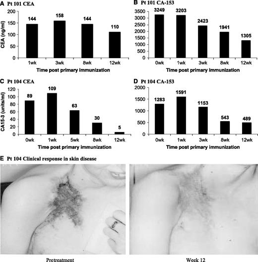 Fig. 2. Measurement of surrogate markers of tumor response (A-D). Circulating plasma levels of the surrogate markers CEA (A and C) and CA15-3 (B and D) in patients 101 (A and B) and 104 (C and D) are illustrated throughout the 12-week clinical follow-up period. Results are expressed as ng CEA/mL plasma or as units CA15-3/mL plasma. E, clinical photographs of skin response in patient 104.