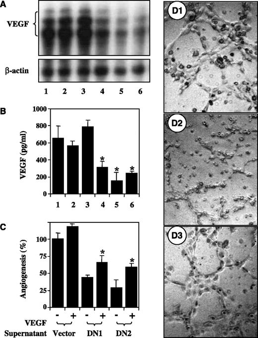 Fig. 3. Genetically enforced down-regulation of activated Stat3 expression suppresses VEGF expression and impairs angiogenic potential in human gastric cancer cells. Cellular mRNA was extracted from AGS cells (lane 1), AGS cells transfected with a control vector (AGS-Neo1, lane 2 and AGS-Neo2, lane 3), or AGS cells transfected with pStat3-DN expression vector (AGS-DN1, lane 4; AGS-DN2, lane 5; and AGS-DN3, lane 6). VEGF mRNA expression was determined using Northern blot analysis (A). Equal loading of RNA samples was monitored by hybridizing the same membrane filter with a human β-actin cDNA probe. Culture supernatant was harvested after 48 hours of incubation of 2 × 106 cells in 10 mL medium. VEGF protein secretion was determined by ELISA (B). The angiogenic potentials of the supernatant of control transfected AGS cells (vector) and pStat3-DN-transfected AGS cells (DN1 and DN2) with or without the addition of 10 ng/mL VEGF were determined by an endothelial cell tube formation assay. The degree of tube formation was assessed as the percentage of cell surface area versus total surface area. Columns, % angiogenesis; bars, SE. Empty vector-transfected cell cultures were given arbitrary percentage values of 100 (C). Representative pictures were taken in situ for tube formation in the supernatant of control transfected AGS cells (D1), pStat3-DN-transfected AGS cells (D2), and pStat3-DN-transfected AGS cells with the addition of 1 ng/mL VEGF (D3). Note that blockade of Stat3 activity suppressed VEGF expression and impaired the angiogenic phenotype of gastric cancer cells. *, P < 0.01, statistical significance as comparisons were made between the Stat3-DN-transfected cells and respective control groups.