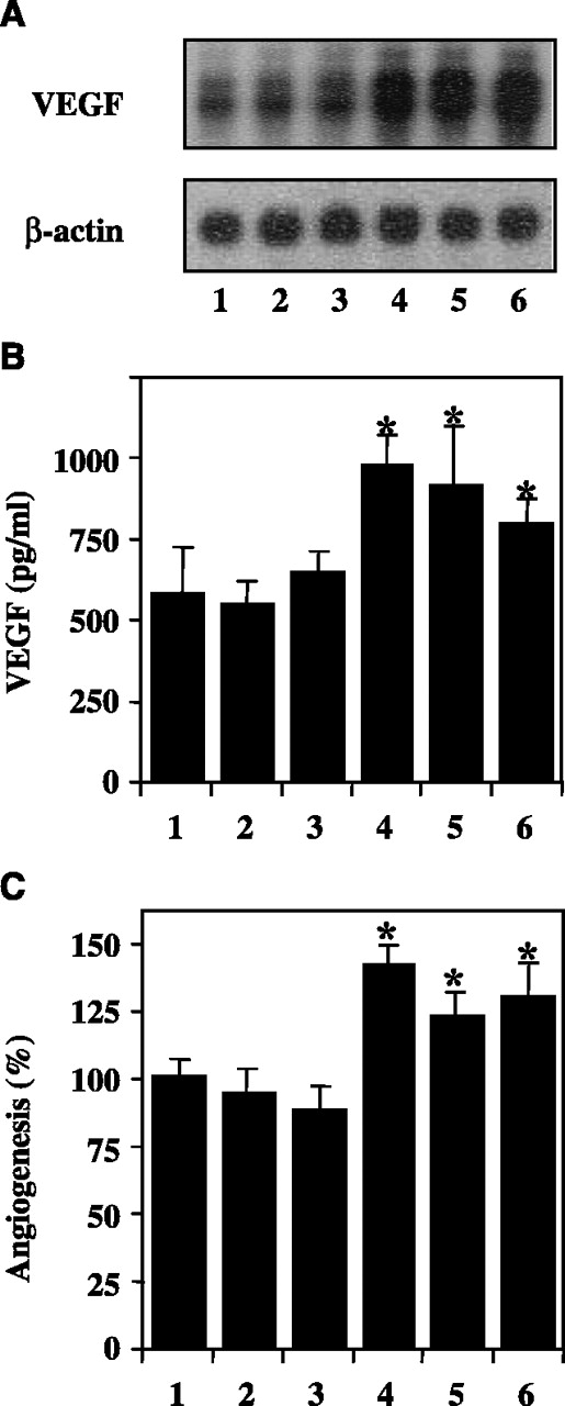 Fig. 4. Genetically enforced up-regulation of activated Stat3 expression increased VEGF expression and angiogenic potential in human gastric cancer cells. Cellular mRNA was extracted from AGS cells (lane 1), AGS cells transfected with a control GFP expression vector (AGS-GFP1, lane 2 and AGS-GFP2, lane 3), or AGS cells transfected with pStat3-CA expression vector (AGS-CA1, lane 4; AGS-CA2, lane 5; and AGS-CA3, lane 6). VEGF mRNA expression (A), VEGF protein secretion assay (B), and the angiogenic potentials of the supernatants of tumor cell cultures (C) were determined as described in Fig. 3. Note that increased Stat3 activity up-regulated VEGF expression and increased the angiogenic phenotype of gastric cancer cells. *, P < 0.01, statistical significance as comparisons were made between the Stat3-CA-transfected cells and respective control groups.