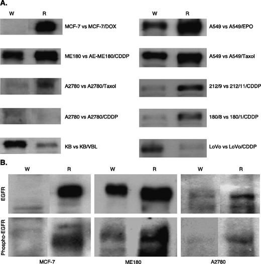 Fig. 1. Total HER1/EGFR expression and baseline phospho-HER1/EGFR activity in chemosensitive parental and chemoresistant variant cell lines. A, total HER1/EGFR expression determined by Western blot analysis. Thirty micrograms of total cellular lysates prepared from chemosensitive parental (W) and chemoresistant variant cells (R) were resolved by 7.5% SDS-PAGE, transferred to a nitrocellulose membrane, and blotted with anti-EGFR antibody as described in Materials and Methods. B, baseline phospho-EGFR activity in three pairs of chemosensitive parental (W) and chemoresistant resistant (R) sublines determined by Western blot analysis. The samples were resolved by 12% SDS-PAGE and anti-phospho EGFR antibody was used for immunoblotting as described in Materials and Methods.