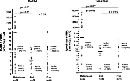 Fig. 2. Quantitative RT-PCR analysis of MART-1 and tyrosinase mRNA in SNs from 95 patients. Each patient is represented by one SN (the highest expressive). Horizontal line, median. For MART-1 patients with SN without melanocytic cells, the median was zero.
