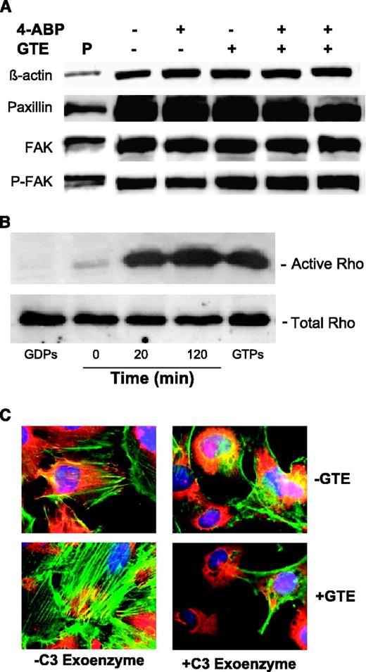 Fig. 4. GTE-induced actin polymerization and stress fiber formation is associated with increased Rho activity. Immunoblot analysis (A) showed very little change of expression for phospho-FAK, FAK, and paxillin in cells treated with either GTE (40 μg/mL), 4-ABP (200 μmol/L), or both for 24 hours. However, GTE-induced Rho activity, as in B, in which GTP is a positive control and GDP is a negative control for the activity of Rho. C, GTE-induced stress fiber and focal adhesion complex formation was blocked by preloading the cells with C3 exoenzyme for 12 hours. Images were taken at 100× object under oil immersion.