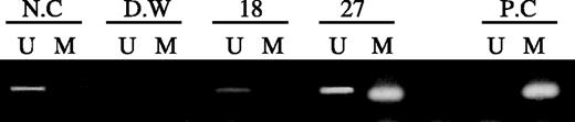 Fig. 1. Methylation-specific PCR of hMLH1 promoter in malignant astrocytomas. Case 18 was unmethylated, whereas case 27 showed methylation. U, PCR product amplified by unmethylated-specific primers; M, PCR product amplified by methylated-specific primers; N.C, normal control; D.W, distribute water; PC, positive control.