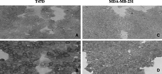 Fig. 3. Immunohistochemical analysis of NIS expression in T47D and MDA-MB-231 cells after infection with (A,C) control virus or, (B,D) Ad5-MUC1-NIS. Strong membrane-targeted immunoreactivity was detected in Ad/MUC1/NIS-infected T47D cells (B). Both the MUC1-negative MDA-MB-231 cells and those cells infected with the promoter-less virus (Ad/NIS) were negative for NIS immunoreactivity.