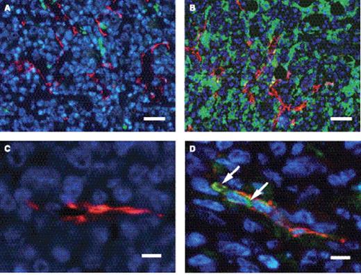 Fig. 6. 3G4 causes monocytes to bind to tumor blood vessels and macrophages to infiltrate tumors. SCID mice bearing orthotopic human breast tumors were treated i.p. with 100 μg of BBG3 (A, C) or 3G4 (B, D) thrice a week for 2 weeks. Tumors were MDA-MB-435 (A, B) or MDA-MB-231 (C, D). Frozen tumor sections were prepared as before. Mouse macrophages and monocytes were detected with rat anti-mouse M1/70 (Mac-1) antibody followed by FITC-labeled anti-rat IgG (green). Anti-F4/80 and anti-FcγR antibodies gave coincident staining patterns with anti-M1/70 antibody and are not shown. Blood vessels were detected with hamster anti-mouse CD31 followed by Texas red–labeled anti-hamster IgG (red). Nuclei were visualized with 4′ ,6-diamidino-2-phenylindole (blue). A, control tumor from mouse treated with BBG3 showing sparse infiltration by macrophages. B, tumor from mouse treated with 3G4 showing abundant macrophage infiltration. C, control tumor from mouse treated with BBG3 showing absence of monocytes attaching to vessel. D, tumor from mouse treated with 3G4 showing monocytes attaching to the luminal surface of tumor vascular endothelium (arrows). Scale bar, 50 μm (A and B) and 10 μm (C and D).