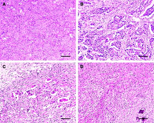 Fig. 3. H&E stains of Mqnu-1 sections (magnification ×193) from animals treated with MEN4901/T-0128 illustrating the classification of histologic changes (bar = 100 μm). Typical example of tumor tissues from animals in the control (A). Tumor samples from animals treated with MEN4901/T-0128 at doses of 1/27, 1/9, and 1/3 of its MTD were classified as grade IIB (B), grade III (C), and grade IVB (D), respectively.