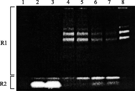 Fig. 4. SDS-PAGE analysis (5% nonreducing gel) of A-431 cell lysates prepared from time-coursed incubations with free BPD or BPD-C225 PIC. The photosensitizer fluorescence of the gel was imaged as described in Materials and Methods. Cell lysates were prepared by incubating cells for various times at 37°C with 280 nmol/L BPD content of free BPD or PIC (7 BPD/antibody). Intact PIC runs in region R1, and broken down PIC or free BPD runs in region R2. (Lane 1) cells incubated with media only, (lane 2) cells incubated for 1 hour with free BPD, (lane 3) cells incubated for 40 hours with free BPD, (lane 4) cells incubated for 1 hour with PIC, (lane 5) cells incubated for 4 hours with PIC, (lane 6) cells incubated for 17 hours with PIC, (lane 7) cells incubated for 40 hours with PIC, and (lane 8) 0.5 μL of the original 30 μmol/L (BPD content) stock solution of PIC.