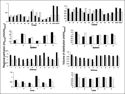 Fig. 3. Effect of nicotinamide and carbogen on regional perfusion (left column) and volume of distribution of water (Vd; right column) in tumor, spleen, kidney (right and left), and liver. Data for 12 liver and 2 lymph node (LN) metastases analyzed in six patients (1 to 6, individual patients; a to d, separate metastases analyzed). Black columns, without nicotinamide and carbogen; dotted columns, with nicotinamide and carbogen. Measurements were not obtained for all metastases (Table 1).