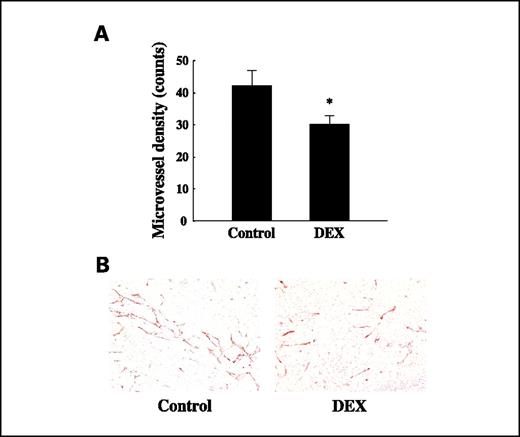 Fig. 6. Effects of in vivo treatment of dexamethasone on tumor angiogenesis. A and B, microvessel quantification and immunohistochemical analysis of neovascularization with the use of an antibody against the endothelial cell marker CD34 (brown) in DU145 xenograft tumors, respectively. Microvessel quantification was assessed by comparing microvessel density, which was expressed as the number of vessels per ×200 field. Columns, mean microvessel densities; bars, 95% CI. *, P < 0.01, versus the control group. Original magnification, ×200.