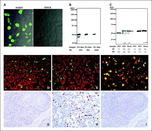 Fig. 1. A to C, establishment of monoclonal antibodies specifically reactive with FOXP3. A, CHO cells were transfected with pcDNA3.1-FOXP3 (FOXP3) or pcDNA3.1 (MOCK). Forty-eight hours after the transfection, cells were immunostained with anti-FOXP3 antibody 42 followed by biotin-conjugated goat-anti-mouse IgG, avidin-biotin complex method reagents, and then FITC-conjugated avidin. B and C, cell lysates from CHO cells transfected with pcDNA3.1-FOXP3 (FP3) or with pcDNA3.1 (Mock) were separated by 10% SDS-PAGE and immunoblotted with anti-FOXP3 antibodies 42, 64, and 243 (B). The diluted cell lysates were immunoprecipitated with anti-FOXP3 antibody 42 and immunoblotted with anti-FOXP3 antibody 64 (C). Arrowhead, FOXP3 protein; arrow, anti-FOXP3 antibody. D to I, FOXP3 is preferentially expressed in CD3+CD4+CD25+ TR located mainly in the paracortical area of lymph nodes. Anti-FOXP3 antibody 42 was used in the experiments. D to F, double immunofluorescent staining of a lymph node on a formalin-fixed paraffin-embedded section. FITC (green) shows positive nuclear staining of FOXP3 and Texas Red (red) shows positive membrane staining of CD4 (D), CD8 (E), and CD25 (F). G to I, immunohistochemical detection of FOXP3+ cells. Peripheral lymph node was immunostained with FOXP3 and counternuclear stained with hematoxylin. FOXP3+ cells were distributed mainly in the paracortical area, although sometimes small numbers of FOXP3+ cells were found in follicles, even in the follicular center. Different parts of the paracortical area in the same lymph node usually showed different numbers of FOXP3+ cells. Low (G) and high (H) magnification. Isotype-matched staining was in (I).