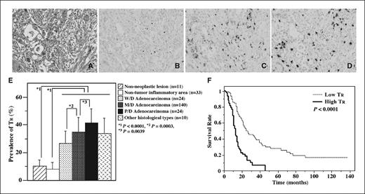 Fig. 2. Increased population of FOXP3+ TR in tumor stroma of pancreatic ductal adenocarcinoma. A to D, representative features of invasive ductal adenocarcinoma of the pancreas, moderately differentiated tubular adenocarcinoma, in HE staining (A) and immunostaining with FOXP3 (B), CD4 (C), and CD8 (D). E, prevalence of TR in stroma of pancreatic ductal adenocarcinoma and nonneoplastic inflammatory lesion. Adenocarcinomas were divided into four categories: well-differentiated tubular adenocarcinoma (W/D; tumor grade 1), moderately differentiated tubular adenocarcinoma (M/D; tumor grade 2), poorly differentiated tubular adenocarcinoma (P/D; tumor grade 3), and other histologic types containing mucinous carcinoma and adenosquamous cell carcinoma. We also evaluated the prevalence of TR in noncancer inflammatory stroma from patients with nonneoplastic pancreatic lesions (nonneoplastic inflammation area) and pancreatic adenocarcinoma (nontumor inflammatory area). F, Kaplan-Meier survival curves of 198 patients. The prognosis was significantly worse in the high prevalence of TR group (solid line; n = 94) compared with the low prevalence of TR group (dotted line; n = 104; P < 0.0001, log-rank test).