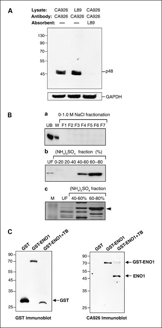 Fig. 1. Purification and identification of immunogenic p48 antigen as human ENO1. A, top, p48-enriched lysate (30 μg) from each cells was electrophorized and immunoblotted with CA926 antibodies or the antibodies preabsorbed with immobilized L89 lysate. The immunoreactions were carried out in an incubation manifold (Hoefer, San Francisco, CA). Glyceraldehyde-3-phosphate dehydrogenase (GAPDH) was used as a protein loading control. Left, molecular weight markers in kDa. B, detergent-soluble L89 lysate was dialyzed and precleared by centrifugation before purification. a, lysate was loaded onto a DEAE column. The bounded proteins were fractionated by increasing concentration of NaCl. Western blotting of unbound (UB), washout (W) lysates, and each fractionated elutants (F1-F7) was done and probed with CA926 effusion antibodies. b, unbound p48-enriched lysates were further fractionated with saturated ammonium sulfate, ranged from 0% to 80%, and immunodetected with CA926 antibodies. c, ammonium sulfate–fractionated lysates were resolved on 10% SDS-PAGE in duplicate. One was probed with CA926 antibodies. The other was visualized by silver staining. The putative immunoreactive protein band in the gel was excised for mass spectrometry analysis. C, gene encoding for human α-enolase (ENO1) was cloned out from L89 cells and expressed as a GST fusion protein. Bottom, Western blotting of 1 μg of GST tag protein and ENO1 recombinant protein with or without thrombin (TB) treatment was hybridized with either GST or CA926 antibodies.