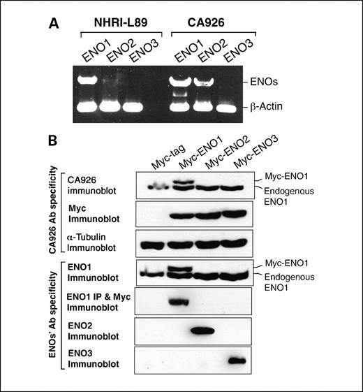 Fig. 2. Specificities of CA926 and rabbit ENO1 antibodies (Ab) to enolase isoforms. A, total RNA was extracted from L89 or CA926 tumor cells and reverse transcribed into cDNA pools. Abundance of each isoform gene was determined by reverse transcription-PCR analysis using a pair of isoform-specific primer as listed in Materials and Methods. β-Actin gene was used as an internal control. B, top, HeLa cells were transfected with a plasmid expressing Myc-tagged ENO1, ENO2, ENO3, or empty vector (Myc-tag). Left, Western blot of each transfected lysates was resolved on a 10% SDS-PAGE and probed with antibodies. For immunoprecipitation (IP) experiment, each transfected HeLa lysate was hybridized with ENO1 antiserum, precipitated with protein G beads, and probed for Myc-tagged proteins. Right, endogenous ENO1 in HeLa cells was labeled.